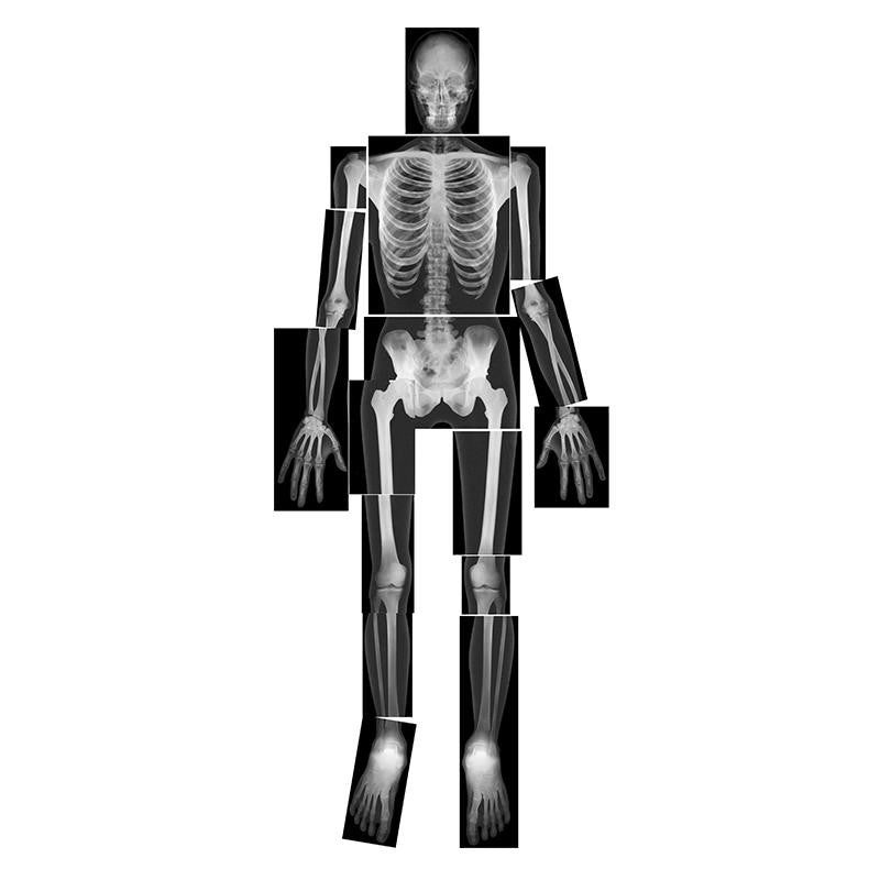 TRUE TO LIFE HUMAN X-RAYS